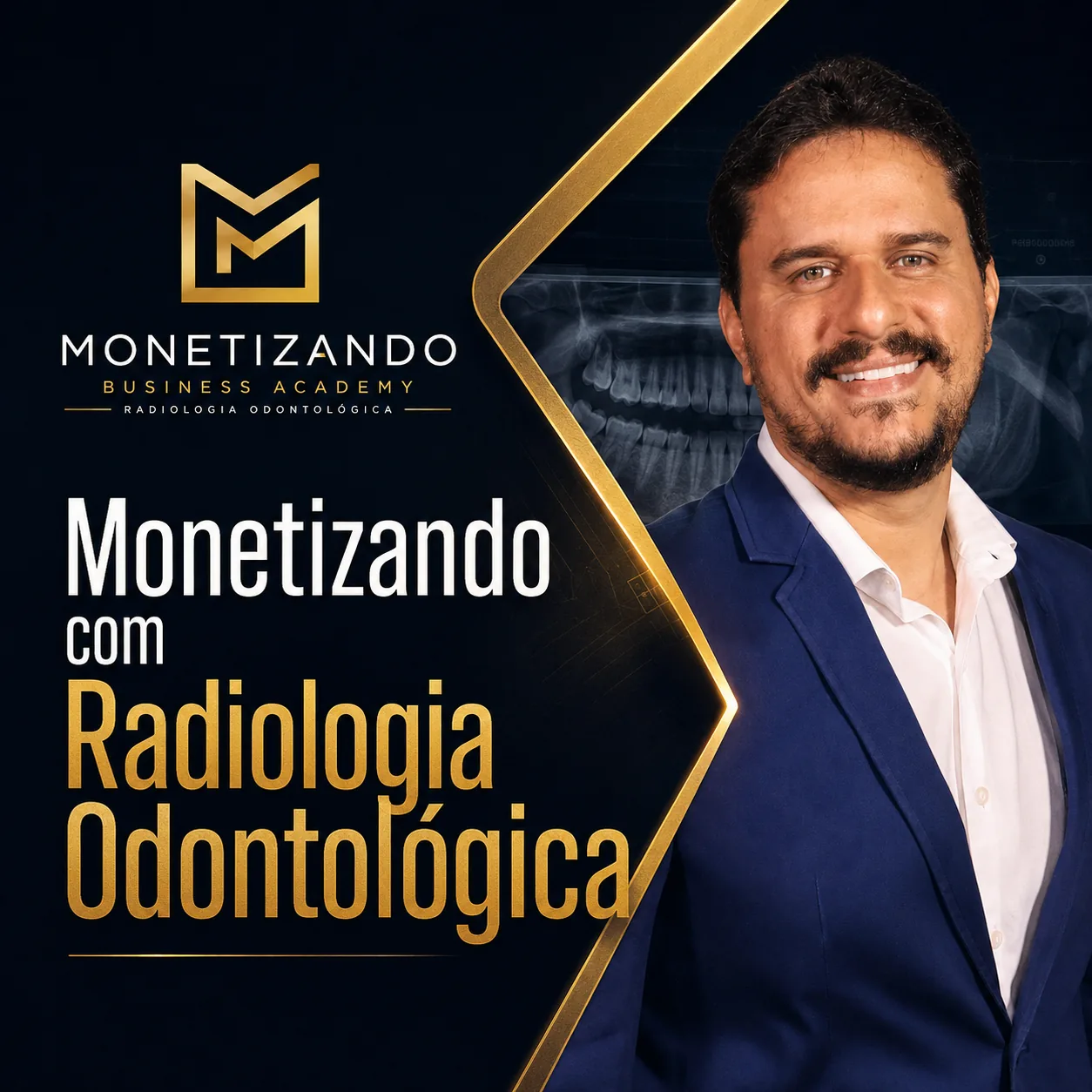 Capa do produto Monetizando com Radiologia Odontológica